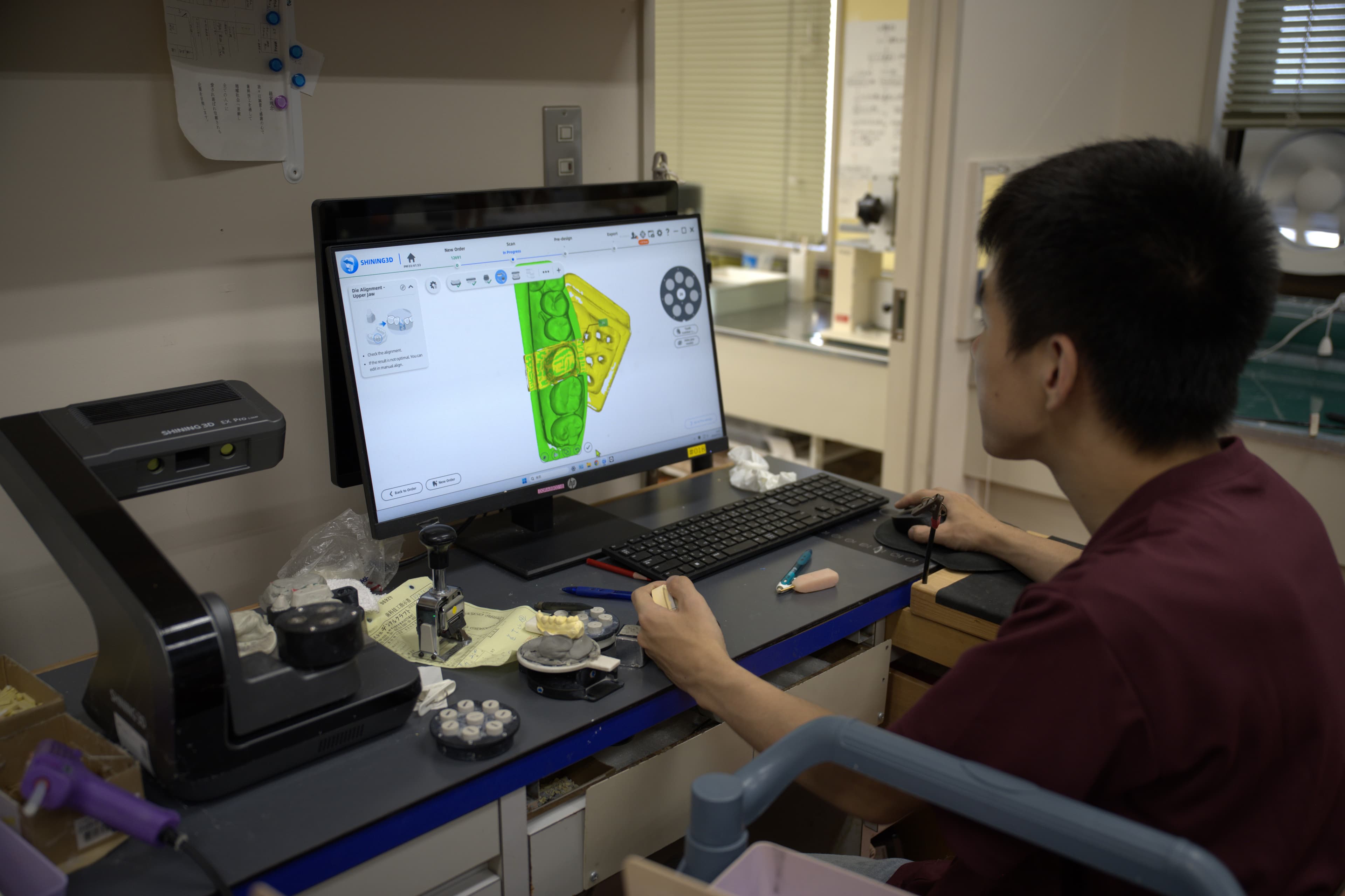口腔内スキャナーとCAD画面を前に作業する技工士